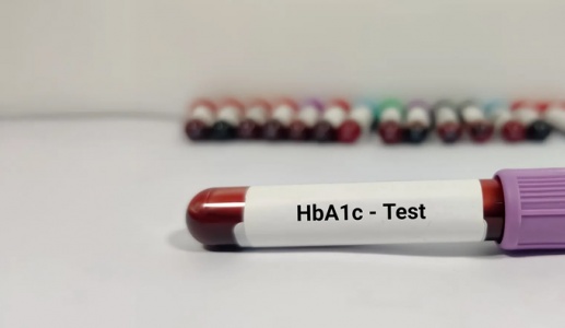 Đái tháo đường: Chỉ số HbA1c 8,9% làm cách nào để hạ?