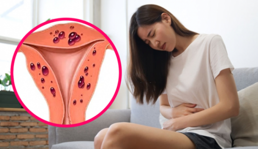 Vì sao lạc nội mạc tử cung thuờng được phát hiện muộn?