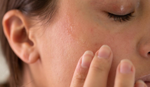 5 nguyên nhân khiến da vẫn khô dù dưỡng ẩm thường xuyên