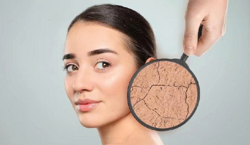 Giải pháp cải thiện tình trạng da khô tại nhà
