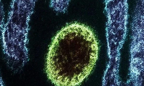Virus Langya mới phát hiện ở Trung Quốc nguy hiểm thế nào?