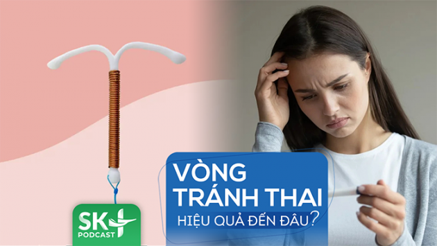 Podcast: Vòng tránh thai hiệu quả đến đâu?