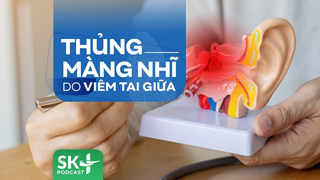 Podcast: Thủng màng nhĩ do viêm tai giữa