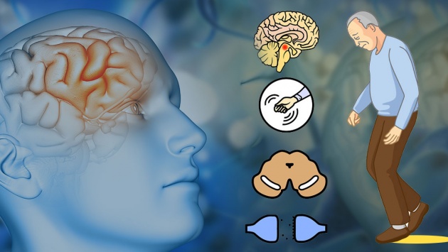 7 tác nhân làm tăng nguy cơ mắc bệnh Parkinson