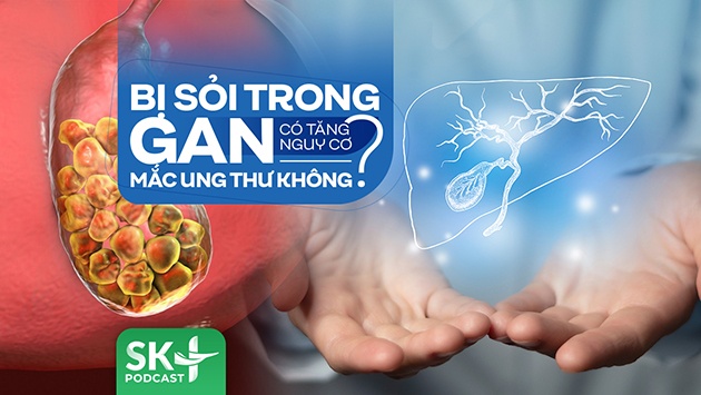 Podcast: Bị sỏi trong gan có tăng nguy cơ mắc ung thư không?