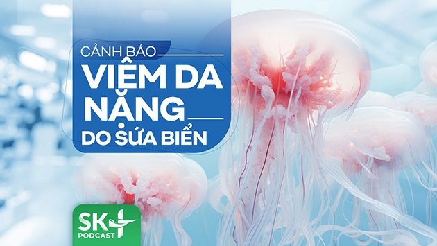 Podcast: Cảnh báo viêm da nặng do sứa biển