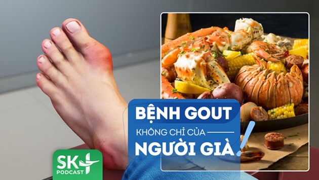 Podcast: Gout không chỉ là bệnh của người trung niên