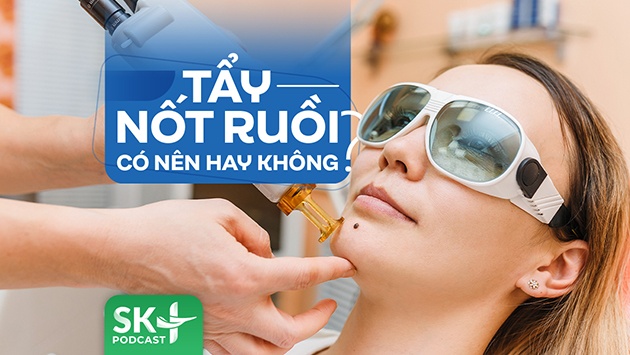 Podcast: Tẩy nốt ruồi có nên hay không?