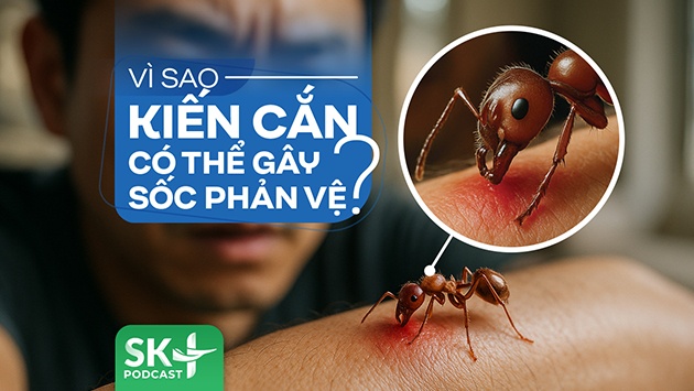 Podcast: Vì sao kiến cắn có thể gây sốc phản vệ?