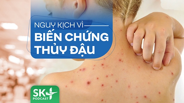 Podcast: Nguy kịch vì biến chứng thủy đậu