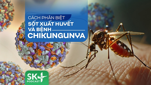 Podcast: Cách phân biệt Sốt xuất huyết và bệnh Chikungunya