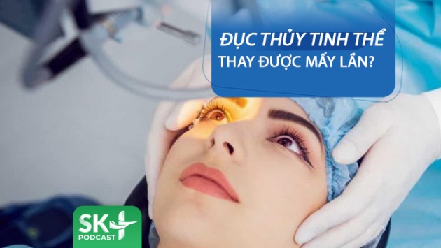 Podcast: Đục thủy tinh thể thay được mấy lần?
