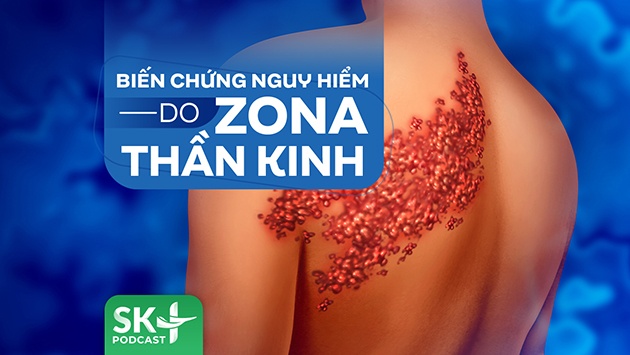 Podcast: Biến chứng nguy hiểm do Zona thần kinh