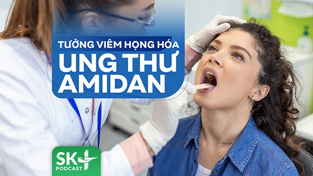 Podcast: Tưởng viêm họng hóa ung thư amidan