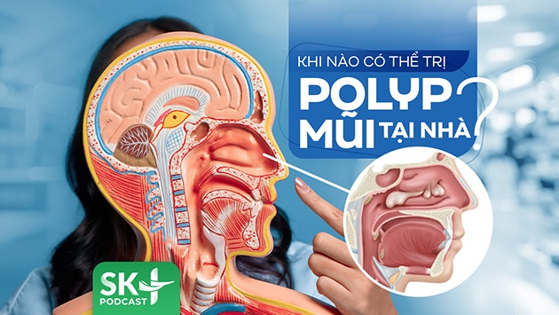 Podcast: Khi nào có thể trị polyp mũi tại nhà?