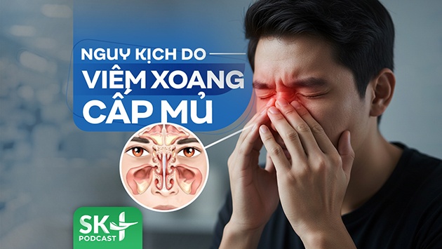 Podcast: Nguy kịch do viêm xoang cấp mủ
