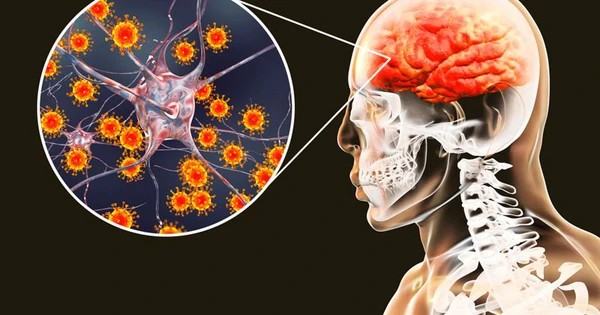 Bệnh viêm não mô cầu diễn biến phức tạp, Bộ Y tế cảnh báo