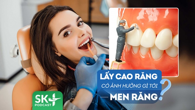 Podcast: Lấy cao răng có gây ảnh hưởng gì tới men răng không?