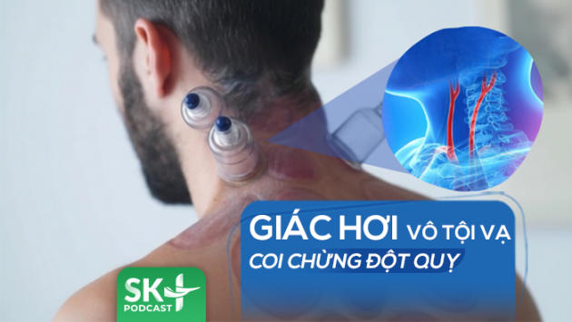 Podcast: Giác hơi vô tội vạ, coi chừng đột quỵ