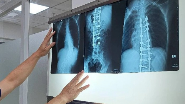 Chụp X-quang không đủ 6 phút bị từ chối thanh toán BHYT, Bộ Y tế vào cuộc