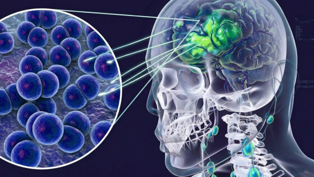 4 trường hợp tử vong do mắc viêm não mô cầu, Bộ Y tế phát cảnh báo