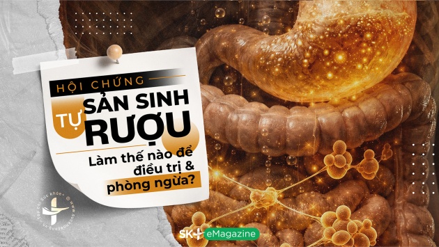 Hội chứng tự sản sinh rượu: Làm thế nào để điều trị và phòng ngừa?