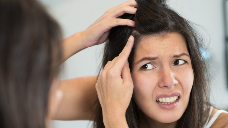Một số thực phẩm giúp ngừa tóc bạc sớm Một số thực phẩm giúp ngừa tóc bạc sớm