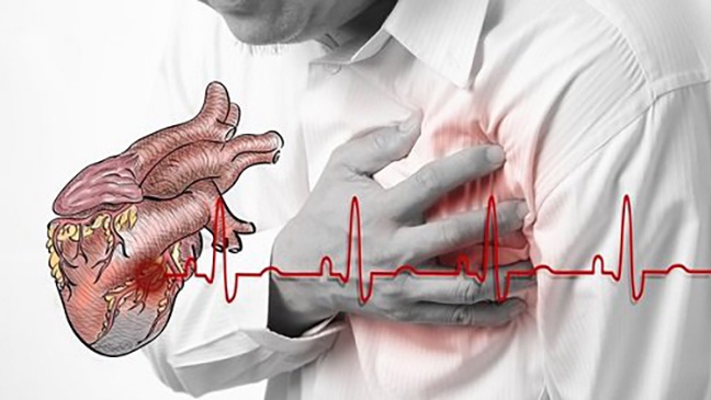 Thiếu máu cơ tim và tất tần tật những thông tin bạn cần biết